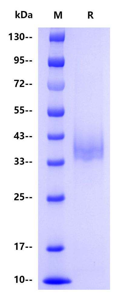 Monkeypox virus E8L His Tag Protein