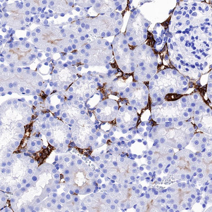 ACE2 Recombinant Rabbit mAb (S-1348-7)