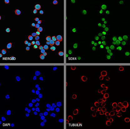 SOX4 Recombinant Rabbit mAb (S-2207-103)