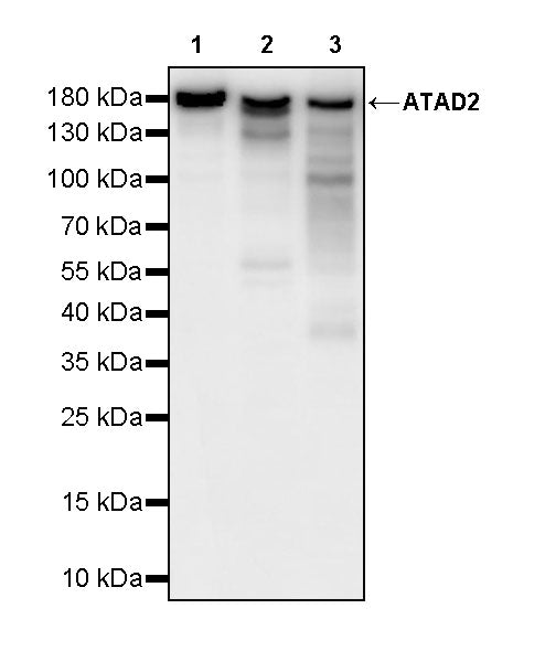 ATAD2 Recombinant Rabbit mAb (S-4145-63)