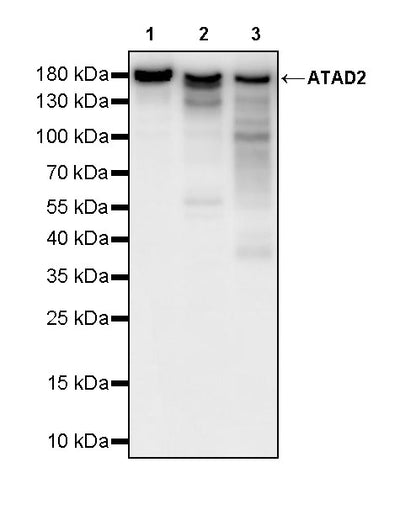 ATAD2 Recombinant Rabbit mAb (S-4145-63)