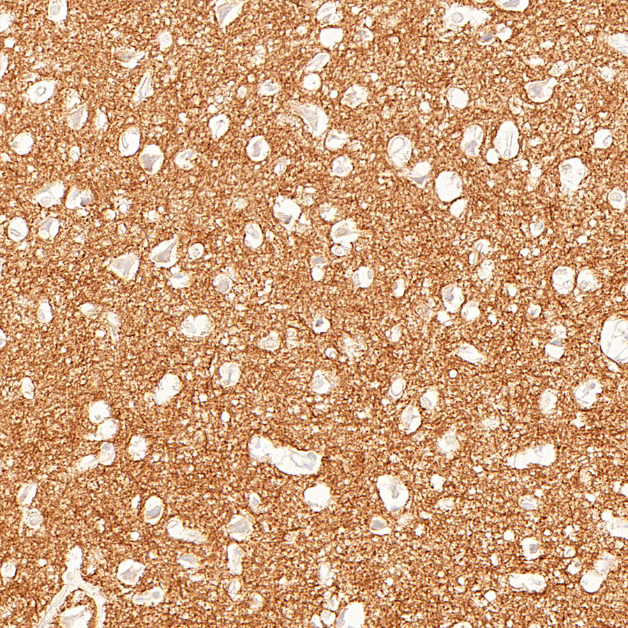 ADAM22 Recombinant Rabbit mAb (S-3201-8)