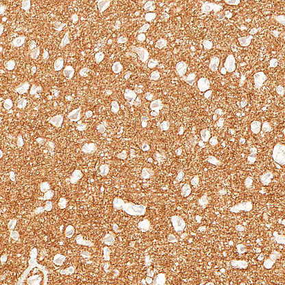 ADAM22 Recombinant Rabbit mAb (S-3201-8)