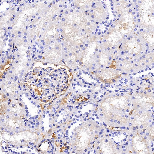 AAT Recombinant Rabbit mAb (S-943-37)