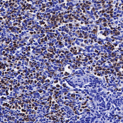 Lysozyme Recombinant Rabbit mAb (SDT-R176)