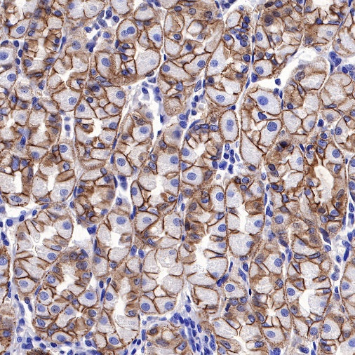 S-RMab® E-Cadherin Recombinant Rabbit mAb (SDT-438-5)