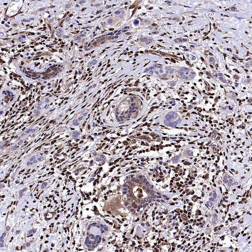 Stat5 Recombinant Rabbit mAb (S-2823-24)