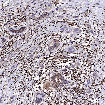 Stat5 Recombinant Rabbit mAb (S-2823-24)