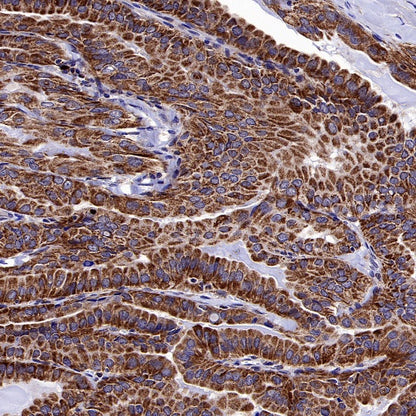GPD2 Recombinant Rabbit mAb (S-2941-41)