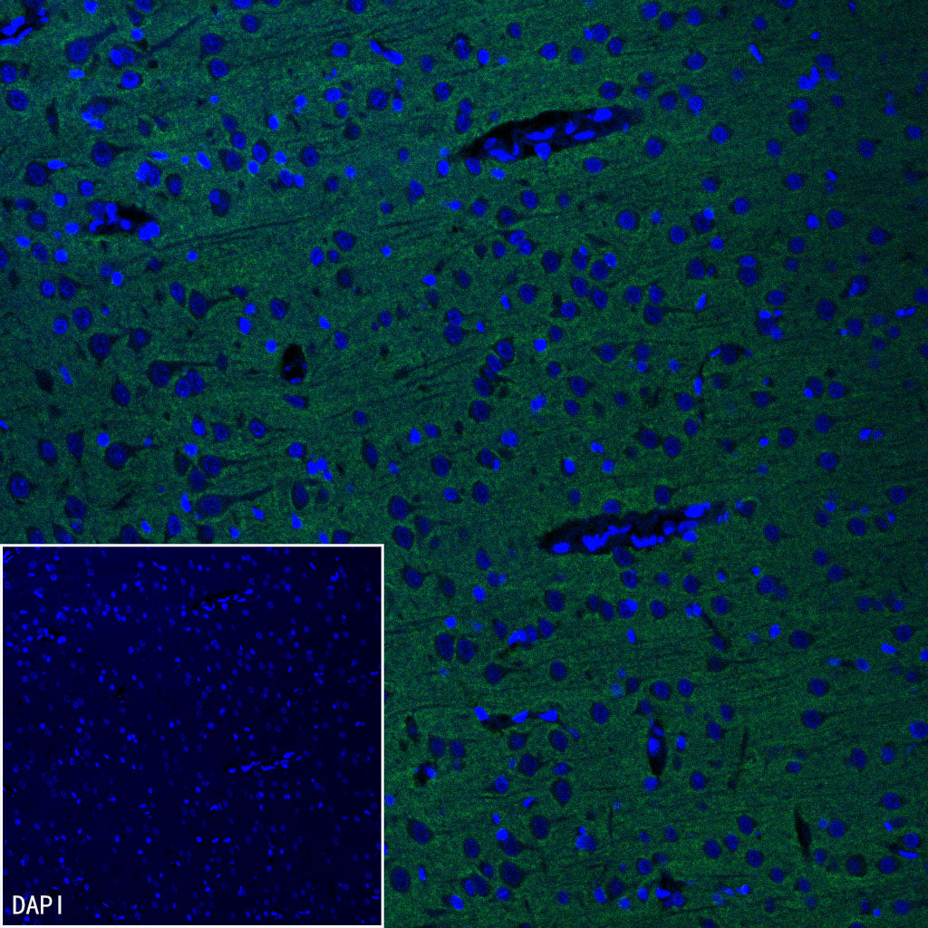 pan SCN Recombinant Rabbit mAb (S-5038)