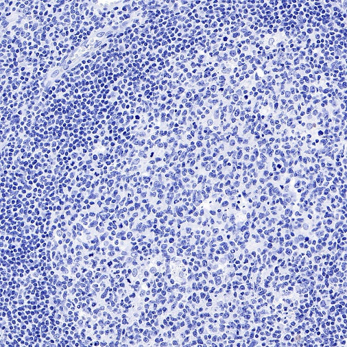 TBR1 Recombinant Rabbit mAb (S-1102-34)