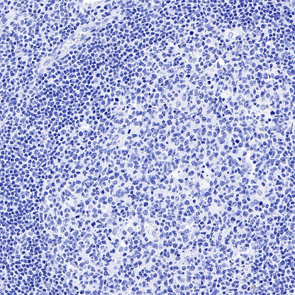 TBR1 Recombinant Rabbit mAb (S-1102-34)