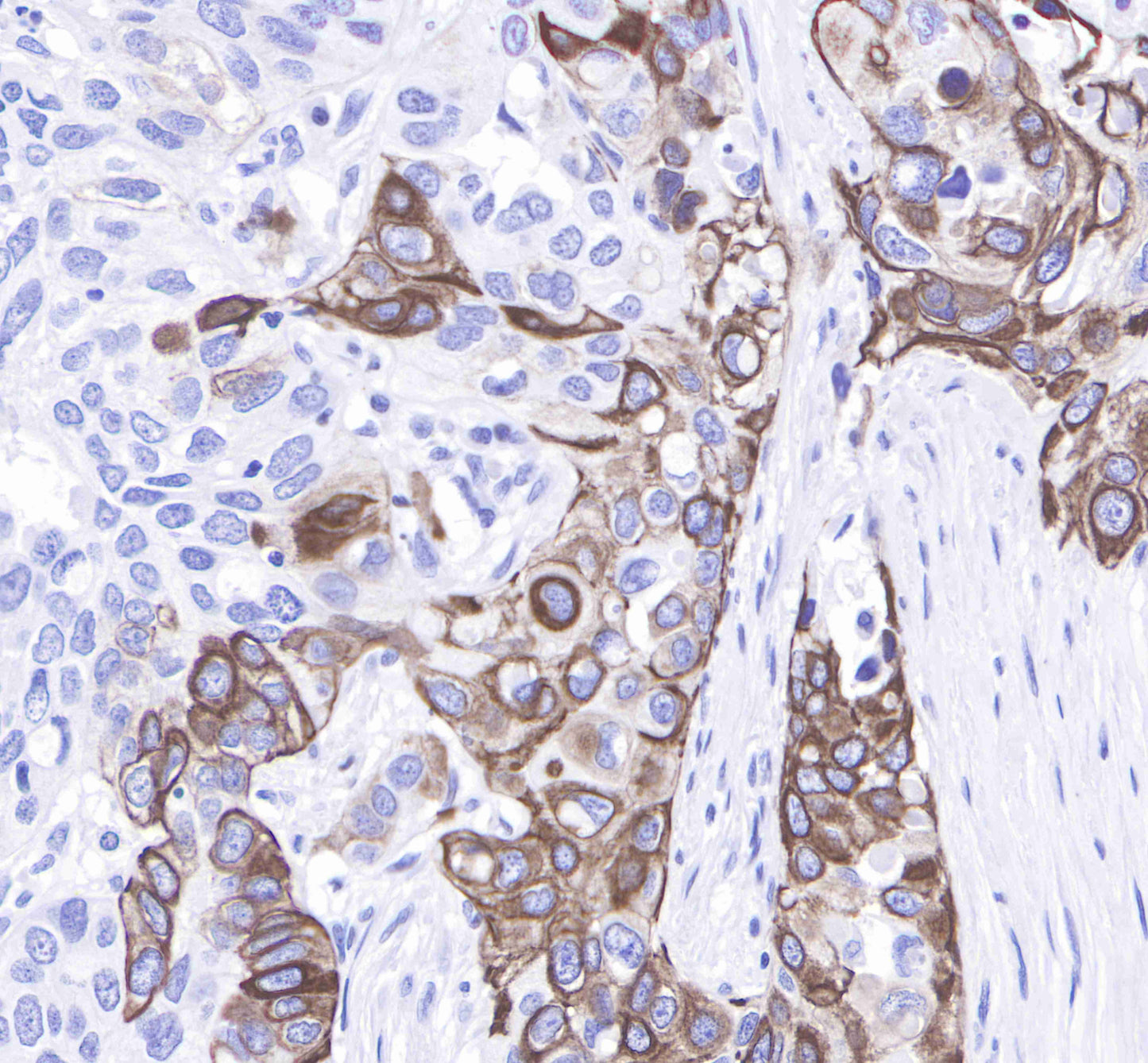 Keratin 14 Recombinant Rabbit mAb(SDT-023-1)