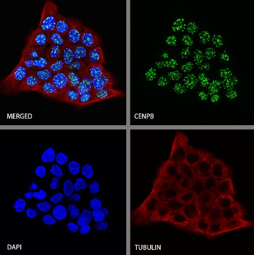 CENPB Recombinant Rabbit mAb (S-1713-209)