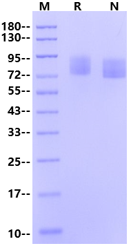 PDGF R alpha/PDGFRA His Tag Protein, Mouse