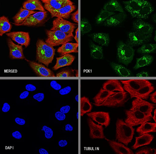 PCK1 Recombinant Rabbit mAb (S-2350-30)
