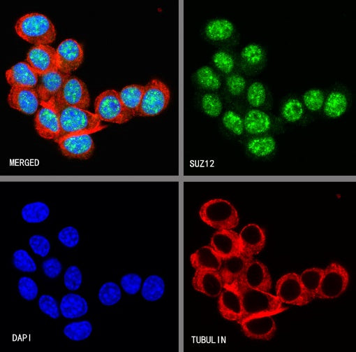 SUZ12 Recombinant Rabbit mAb (S-1689-3)
