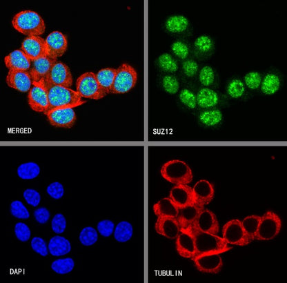 SUZ12 Recombinant Rabbit mAb (S-1689-3)