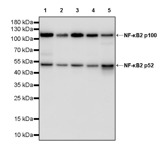 NF-κB2 p100/p52 Recombinant Rabbit mAb (S-2502-208)
