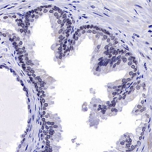 Histone H3 (mono methyl K36) Recombinant Rabbit mAb (S-859-505)