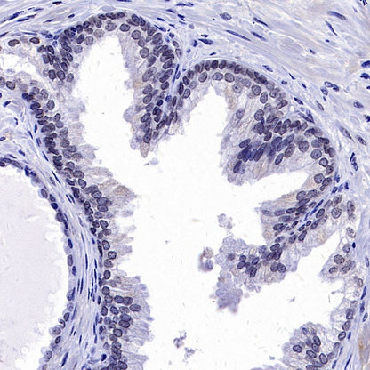 Histone H3 (mono methyl K36) Recombinant Rabbit mAb (S-859-505)