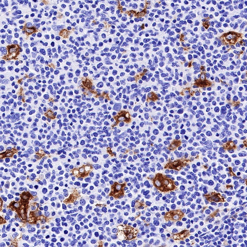 GPNMB Recombinant Rabbit mAb (S-R241)