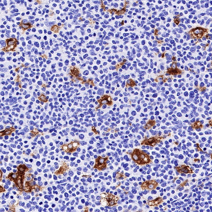 GPNMB Recombinant Rabbit mAb (S-R241)