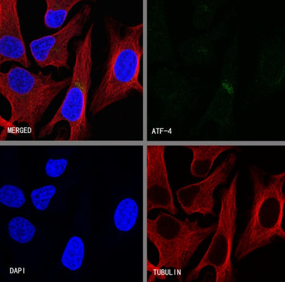 ATF-4 Recombinant Rabbit mAb (S-471-111)