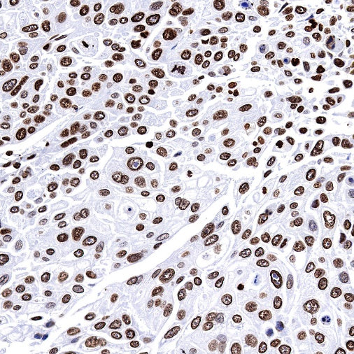 Histone H2B (mono methyl K5) Recombinant Rabbit mAb (S-1416-412)