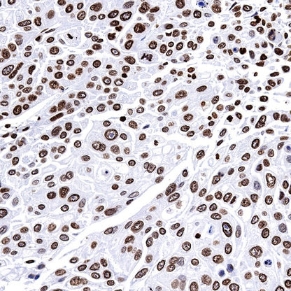 Histone H2B (mono methyl K5) Recombinant Rabbit mAb (S-1416-412)