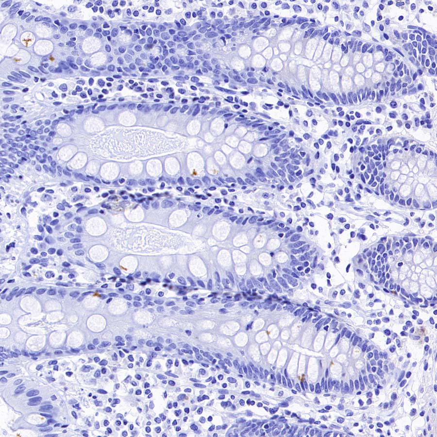 GPR75 Recombinant Rabbit mAb (S-5035)