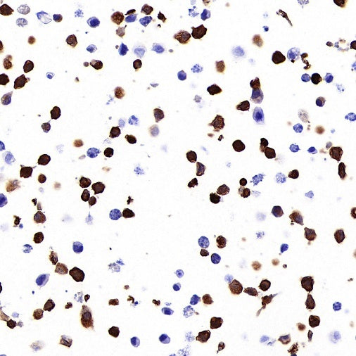 STEAP3 Recombinant Rabbit mAb (S-4466-26)