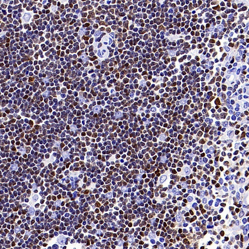 TOX Recombinant Rabbit mAb (S-2296-44)