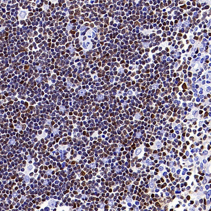 TOX Recombinant Rabbit mAb (S-2296-44)