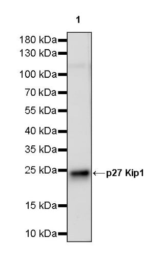 p27 Kip1 Recombinant Rabbit mAb (SDT-361-324)