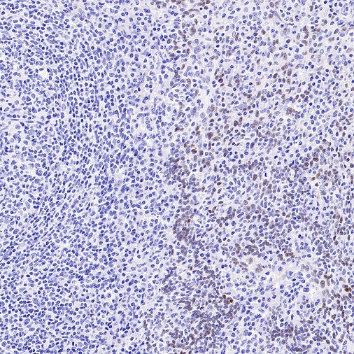 AP2α Recombinant Rabbit mAb (S-2376-7)