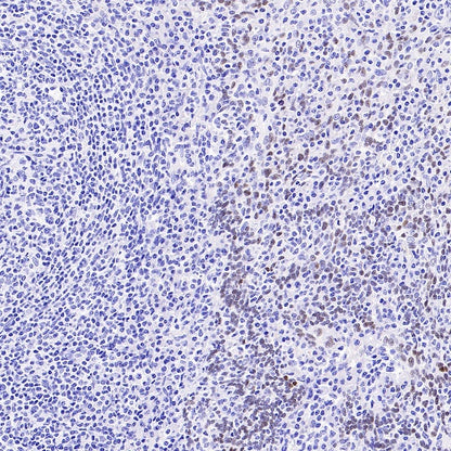 AP2α Recombinant Rabbit mAb (S-2376-7)
