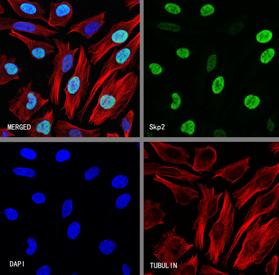 Skp2 Recombinant Rabbit mAb (S-4906)