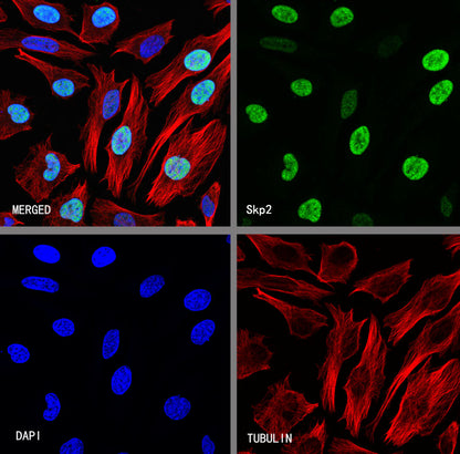 Skp2 Recombinant Rabbit mAb (S-4906)