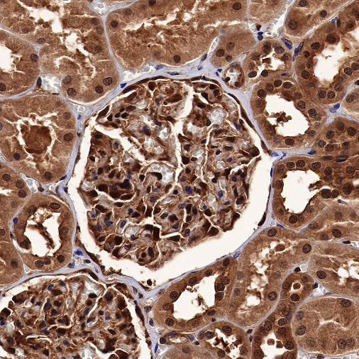 SBDS Recombinant Rabbit mAb (S-R344)