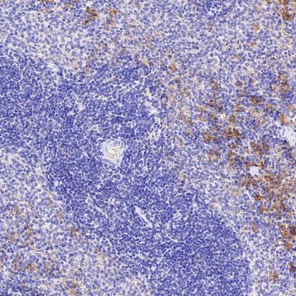 SLC40A1/Ferroportin Recombinant Rabbit mAb (S-2172-35)