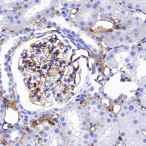 CD31 Recombinant Rabbit mAb (S-R568)