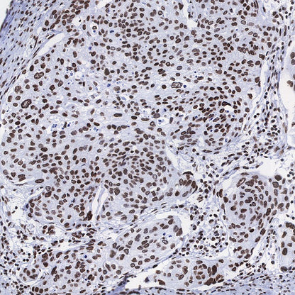 Histone H3 (acetyl K9) Rabbit polyclonal antibody