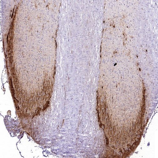 CGRP Recombinant Rabbit mAb (S-2490-74)