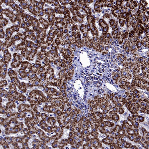 SDHA Recombinant Rabbit mAb (S-1458-43)