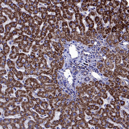 SDHA Recombinant Rabbit mAb (S-1458-43)