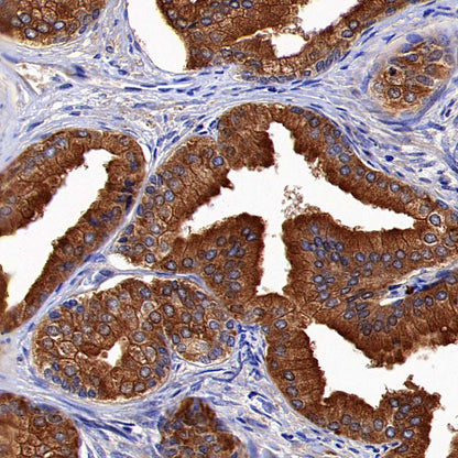 RPS14 Rabbit Polyclonal Antibody
