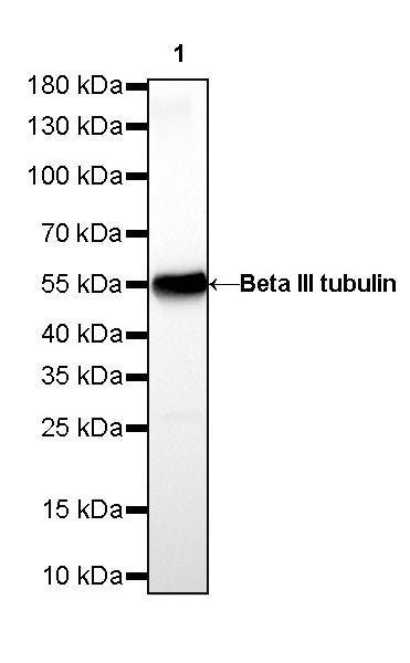 Beta III tubulin Recombinant Rabbit mAb (SDT-251-28)