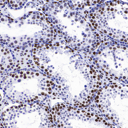 CoREST Recombinant Rabbit mAb (S-4401-8)