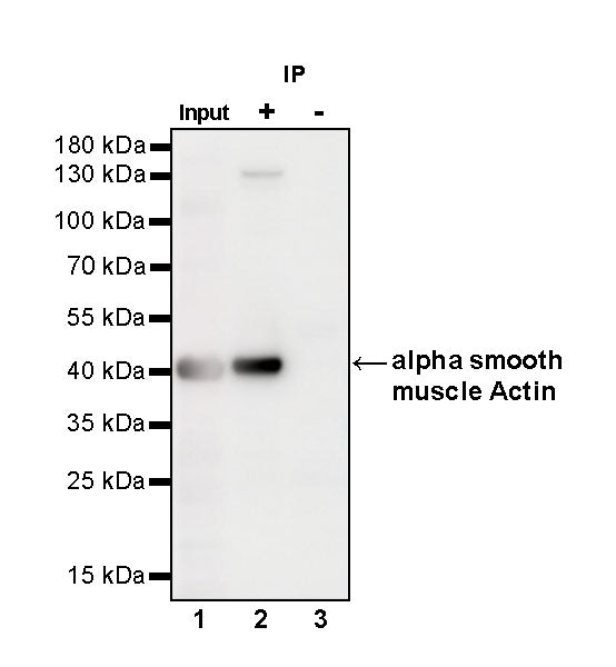alpha smooth muscle Actin Recombinant Mouse mAb (SDT-R142)